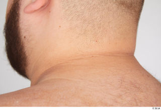 Ronaldo Biggato neck nude 0004.jpg